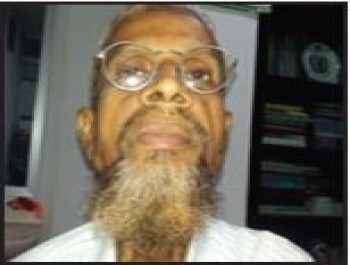 Abdur Rob, 62 years, Tongue cancer, Failed Chemotherapy and radiotherapy