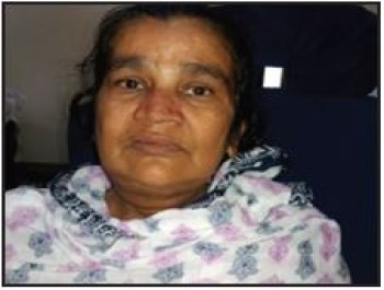 Roksana, 47 years, Tongue Cancer